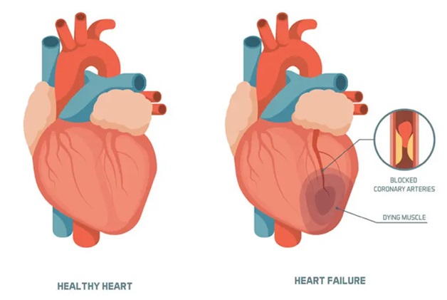 10 lời khuyên về cách phòng tránh bệnh tim mạch