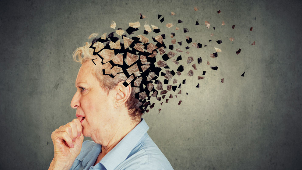 Alzheimer - điều trị như thế nào cho hiệu quả