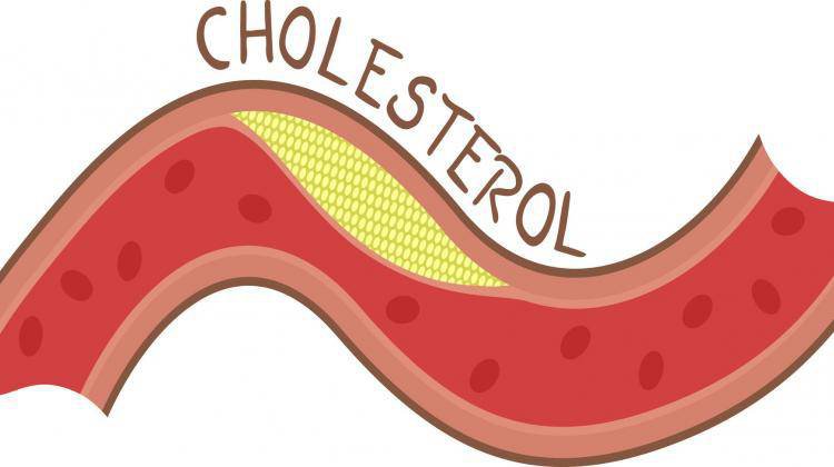 20211228 113807 404435 muc do cholesterol max 1800x1800 (1)