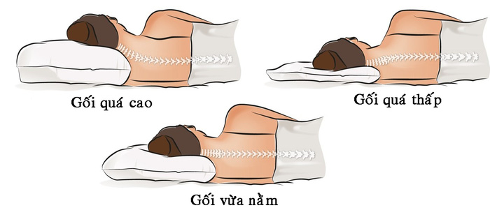 ĐIỀU CHỈNH TƯ THẾ 3