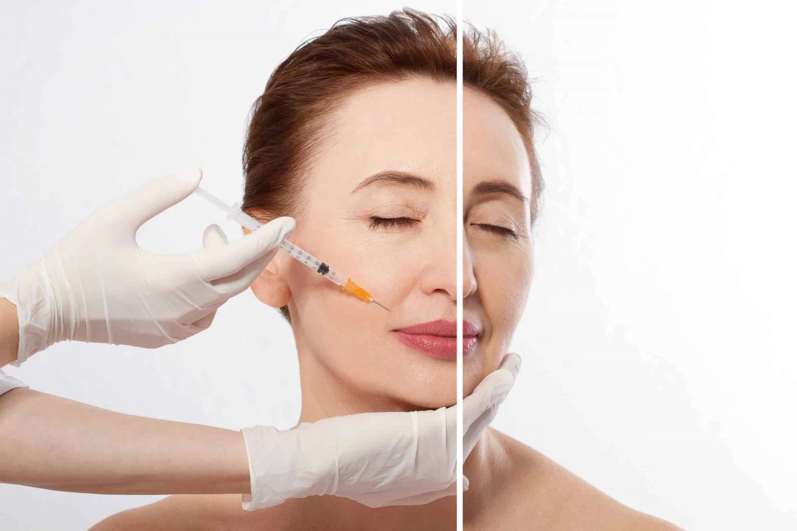 Những lưu ý quan trọng khi bạn tiêm Botox 2