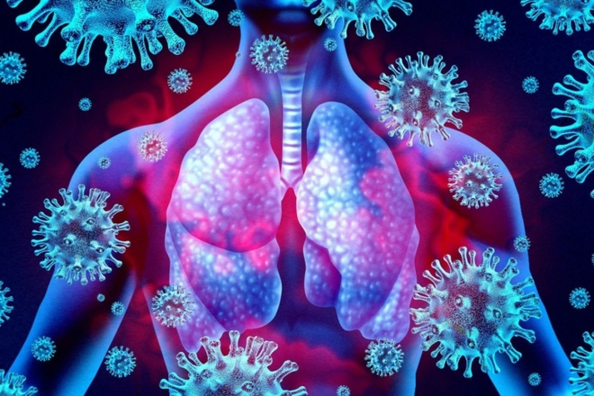 Những vấn đề về phổi thường gặp mà bạn nên biết tránh nguy cơ trầm trọng 1