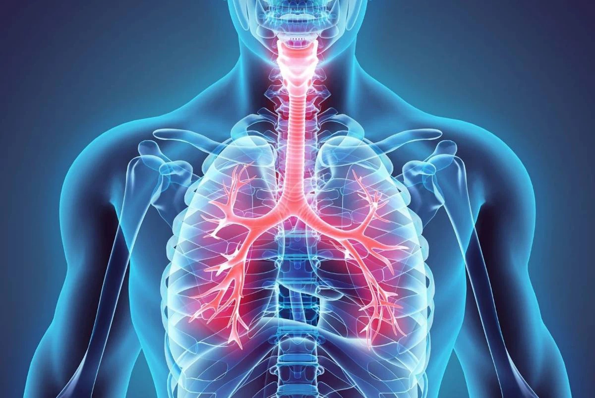 Những vấn đề về phổi thường gặp mà bạn nên biết tránh nguy cơ trầm trọng 3