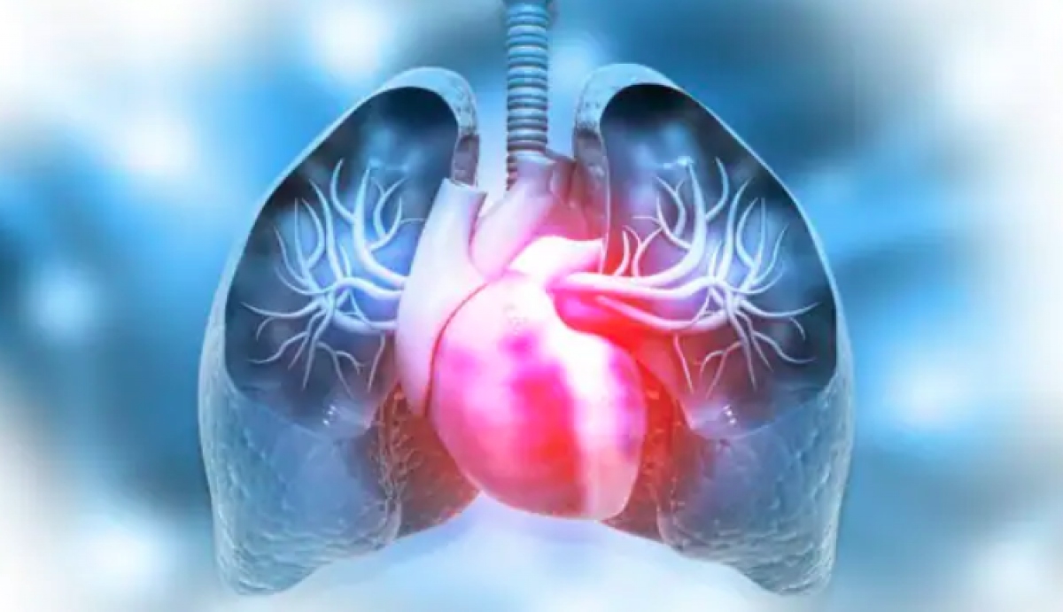 Những vấn đề về phổi thường gặp mà bạn nên biết tránh nguy cơ trầm trọng 4