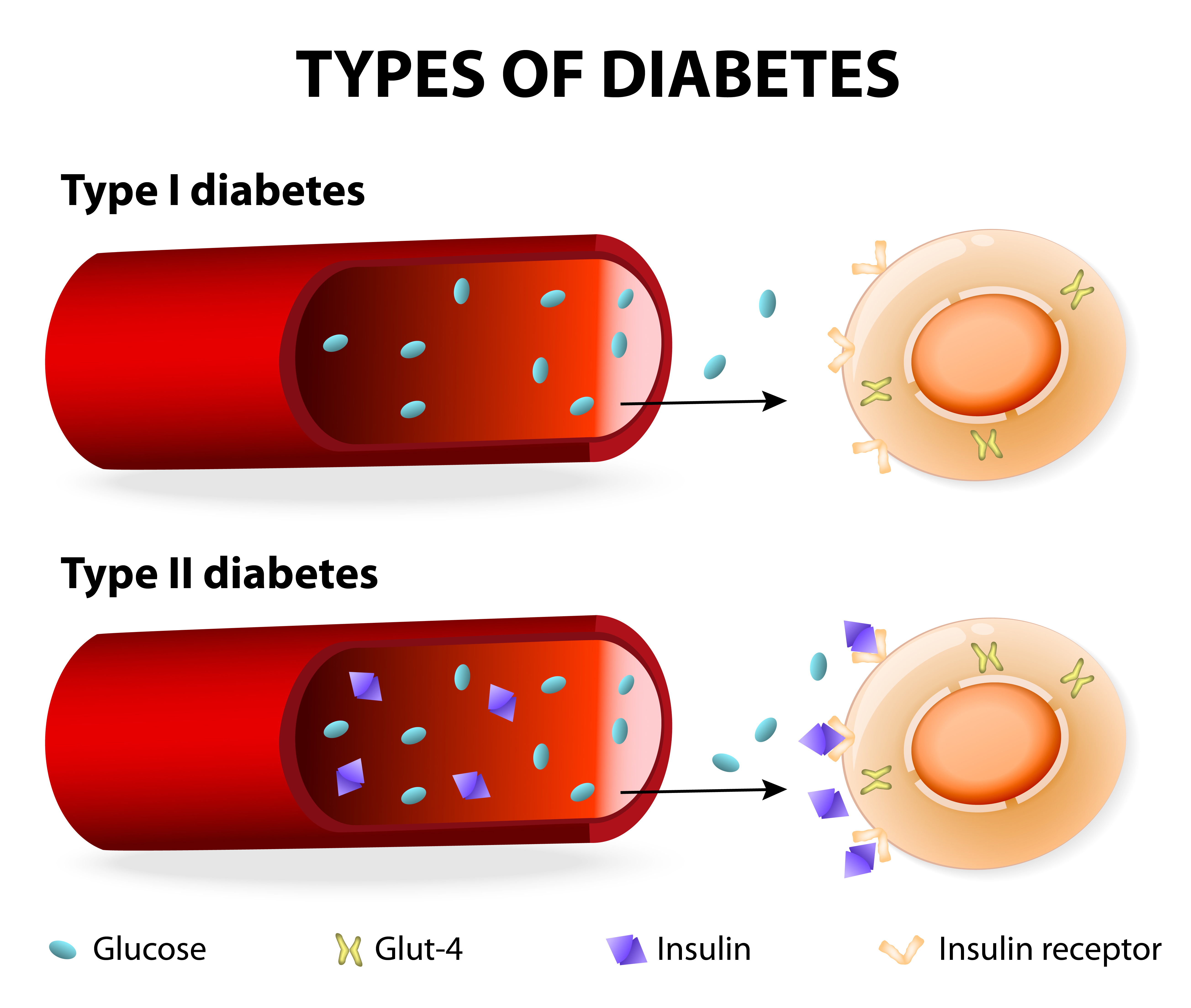 Bệnh tiểu đường có di truyền không 1