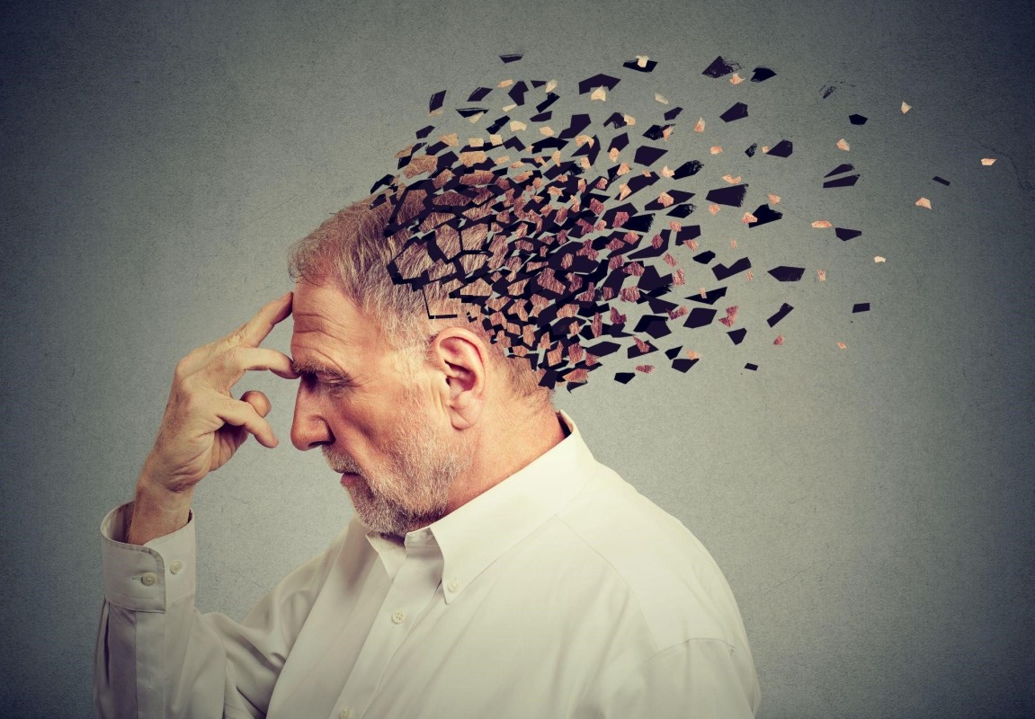 Phát hiện đột phá về bệnh mất trí nhớ Alzheimer 1