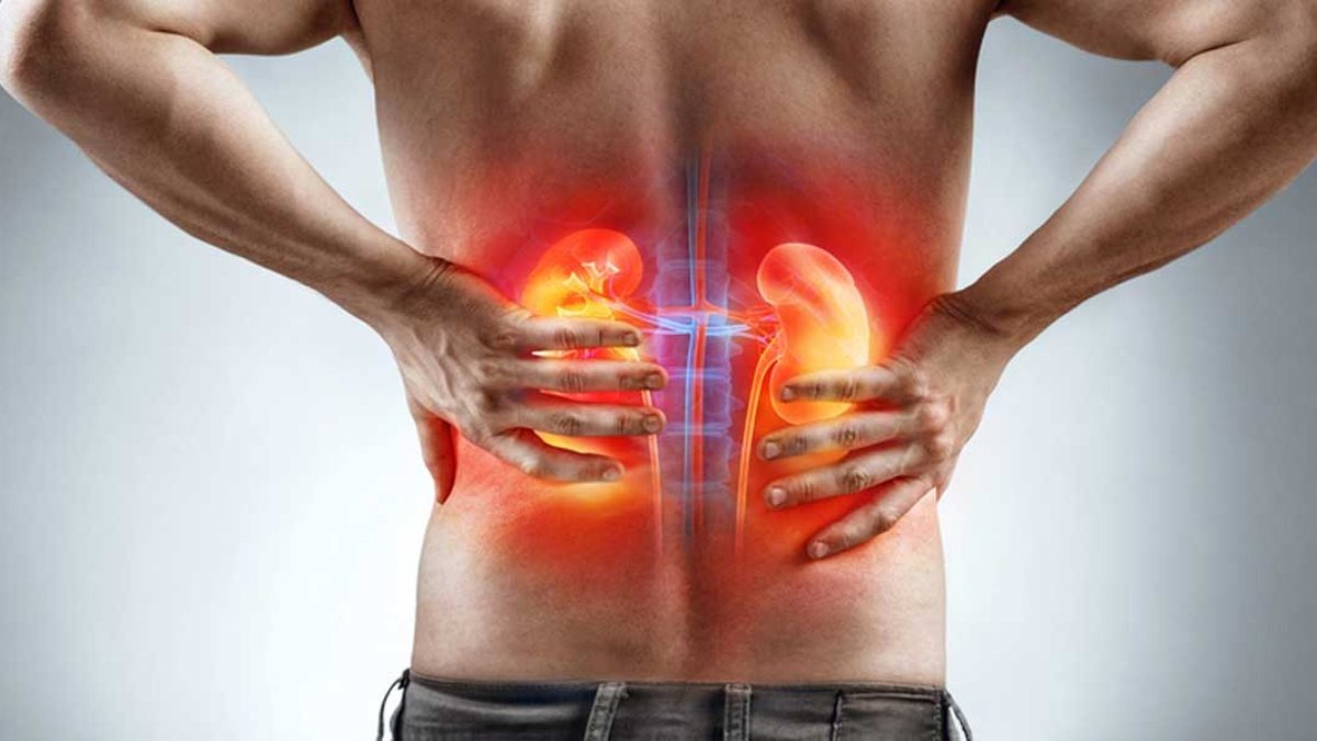 Phân biệt giữa triệu chứng đau thận và đau lưng 2