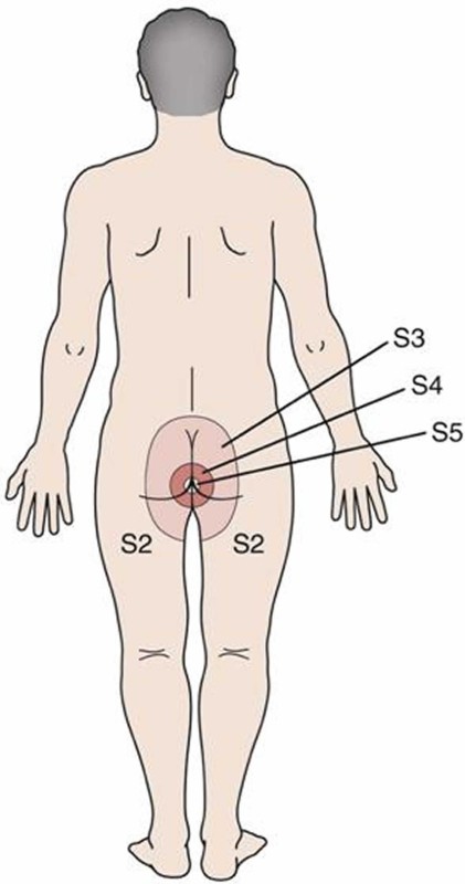 Điều trị thoát vị đĩa đệm 3