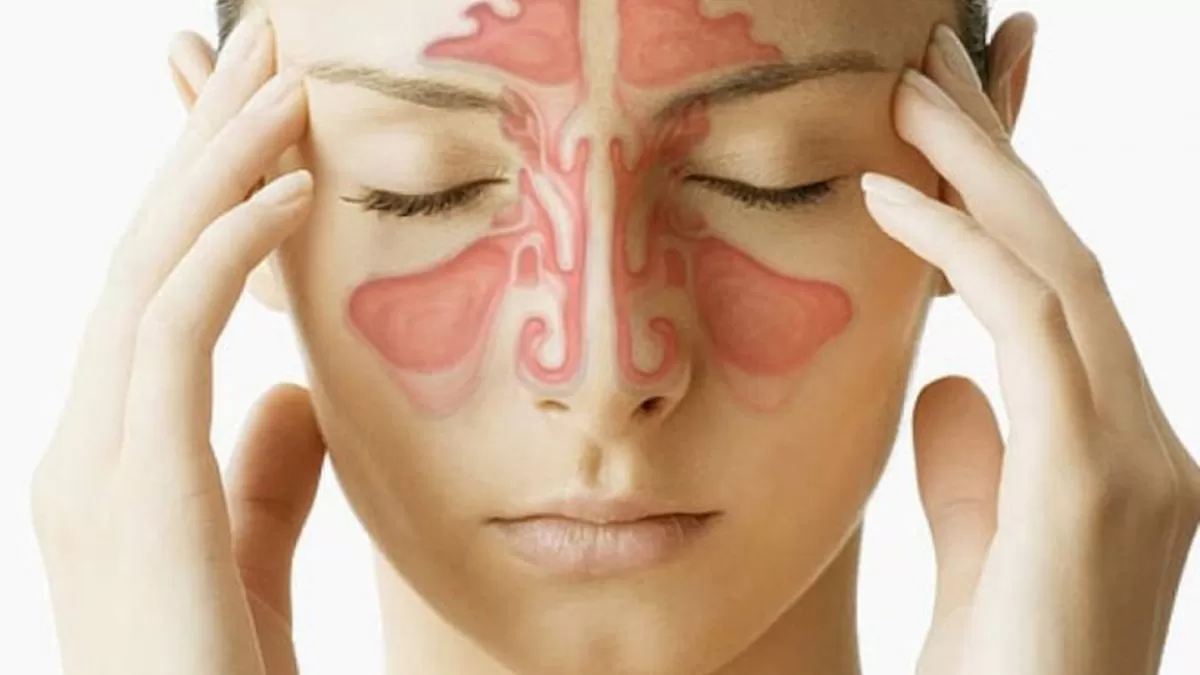 Triệu Chứng Và Cách Điều Trị Bệnh Viêm Xoang Mũi