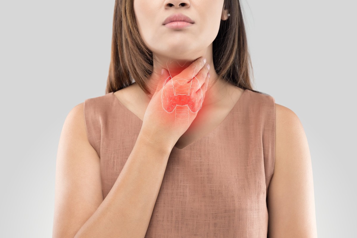 Rụng tóc từng mảng 2